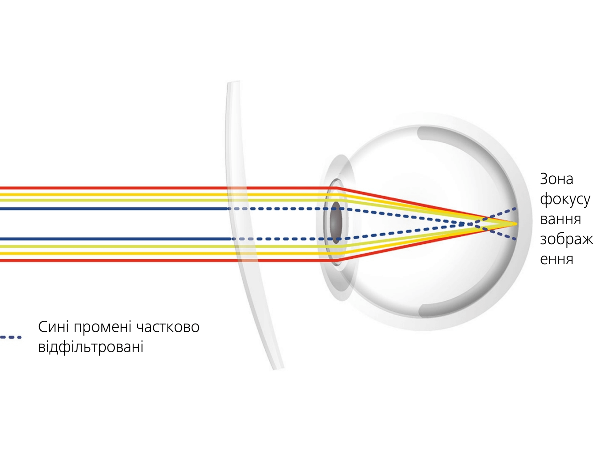 Візуалізація зменшення відблисків покриттям лінзи за рахунок часткового блокування синіх променів 